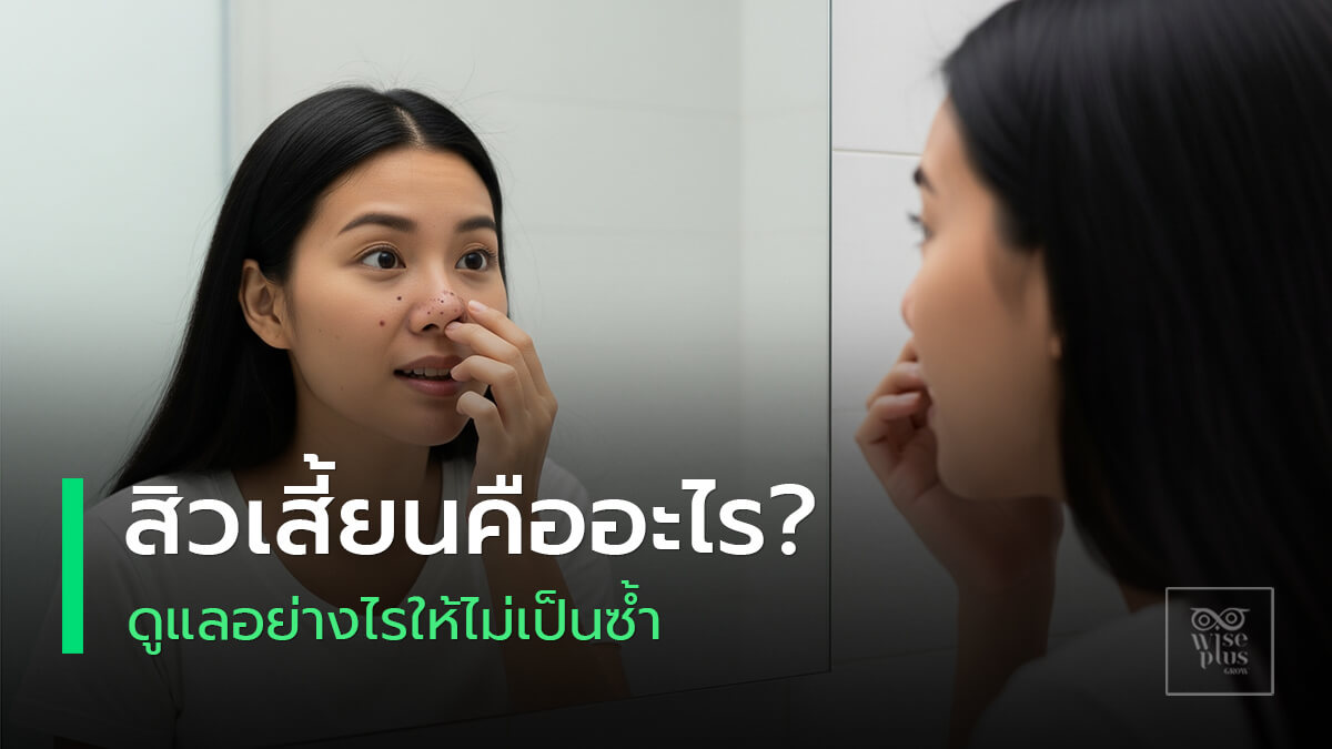 สิวเสี้ยนและวิธีดูแลผิวให้เรียบเนียนอย่างถูกวิธี