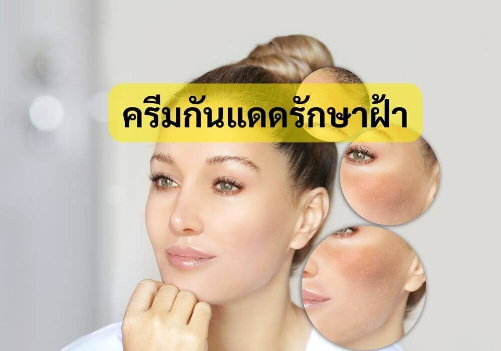 ครีมกันแดดรักษาฝ้า