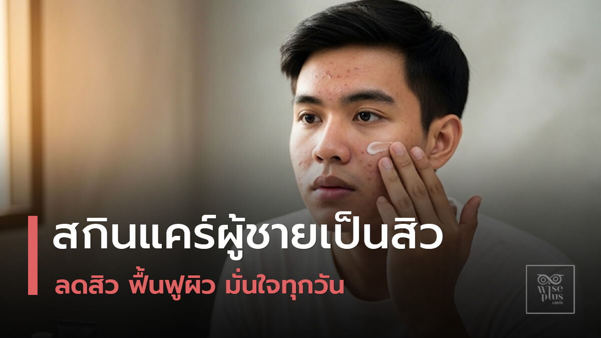 สกินแคร์สำหรับผู้ชายที่มีปัญหาสิว
