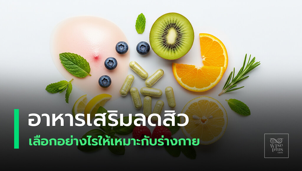 อาหารเสริมลดสิวเพื่อผิวหน้าเนียนใส