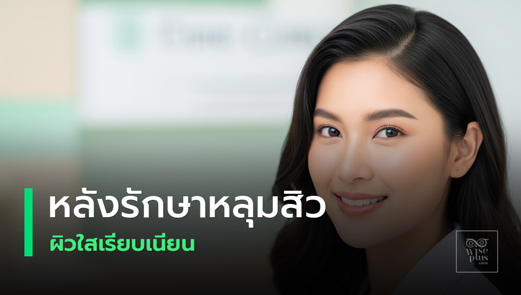 เคล็ดลับดูแลผิวหลังรักษาหลุมสิวให้เรียบเนียน
