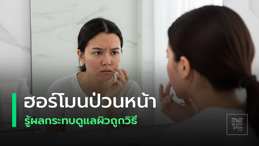 ฮอร์โมนมีผลต่อผิวหน้าอย่างไรและวิธีดูแลให้สวยใส