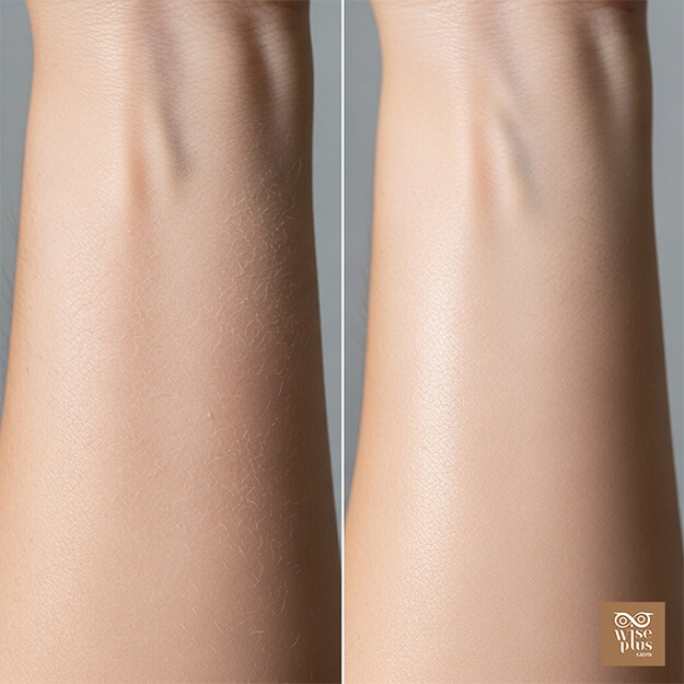 เปรียบเทียบผิวแห้งกับผิวขาดน้ำด้วยภาพผิวจริง