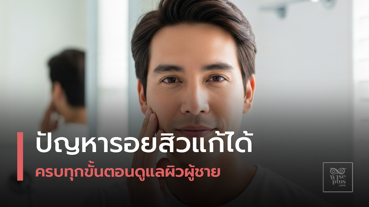 สกินแคร์ผู้ชายลดรอยสิวและจุดด่างดำ
