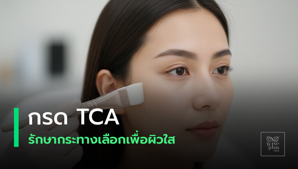 กรด TCA รักษากระ ขั้นตอนและความปลอดภัย